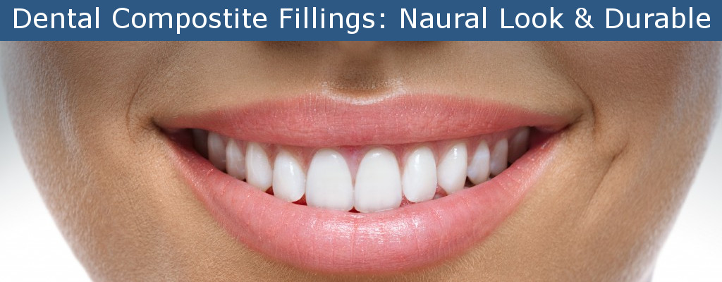 Dental Composite Fillings Natural Look and Durability