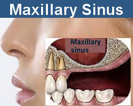 Maxillary sinus location