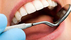 dental exams in Los Angeles