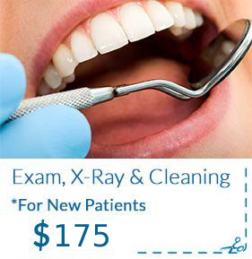 X-Ray & Cleaning Special New Patients