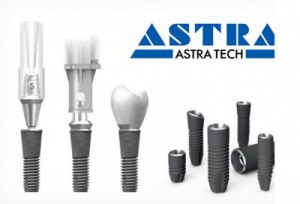 Astra Tech dental implants