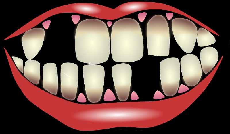 reinserting a knocked out tooth clipart