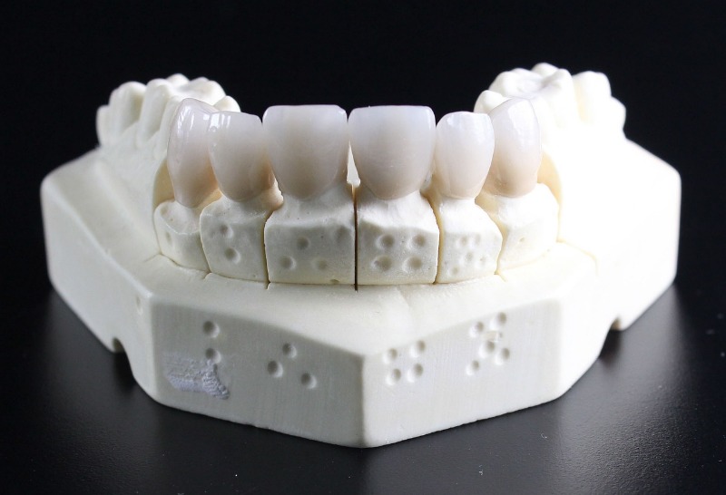 Types of teeth