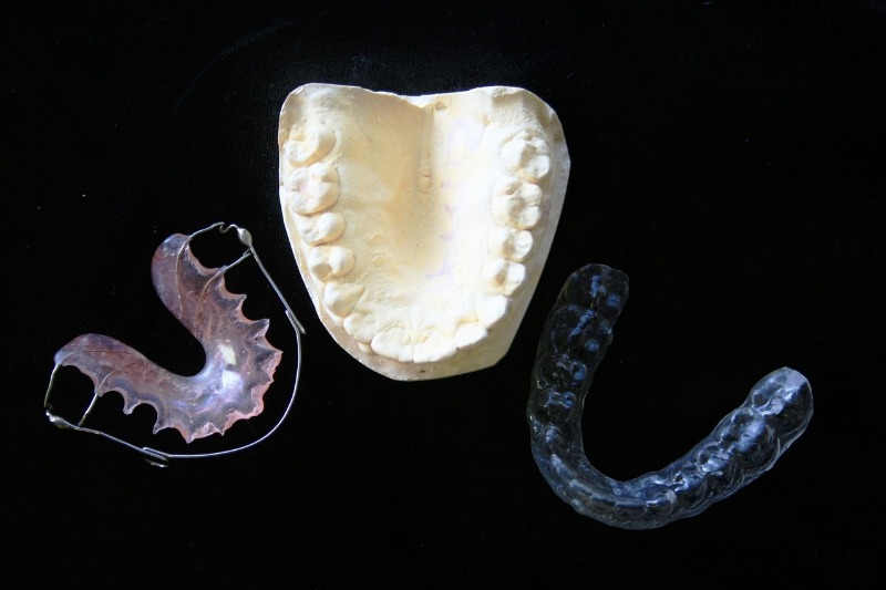 Invisalign