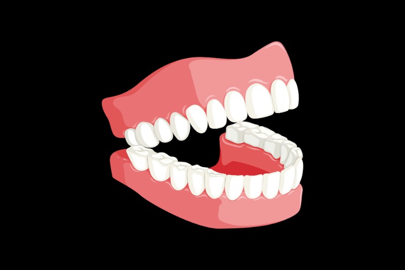 7 Life Changing Benefits of Having Straight Teeth